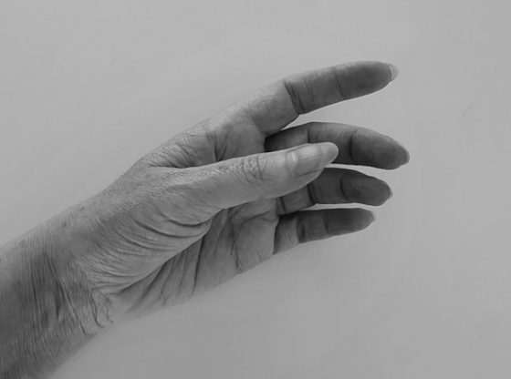Photo "How to calm a person with dementia? Proven techniques that work"